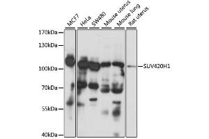 Western blot analysis of extracts of various cell lines, using SUV420H1 antibody. (SUV420H1 抗体)