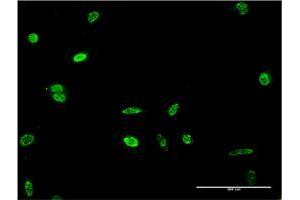 Immunofluorescence of monoclonal antibody to HES2 on HeLa cell. (HES2 抗体  (AA 41-114))