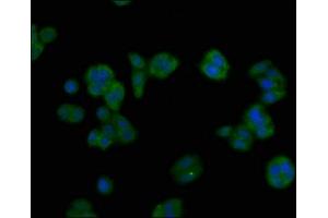 Immunofluorescent analysis of HepG2 cells using ABIN7144709 at dilution of 1:100 and Alexa Fluor 488-congugated AffiniPure Goat Anti-Rabbit IgG(H+L) (Asialoglycoprotein Receptor 1 抗体  (AA 68-291))