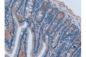 DAB staining on IHC-P; Samples: Rat Intestine Tissue (TNFSF14 抗体  (AA 58-239))