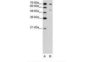 Image no. 1 for anti-Forkhead Box B2 (FOXB2) (AA 51-100) antibody (ABIN6736646) (FOXB2 抗体  (AA 51-100))