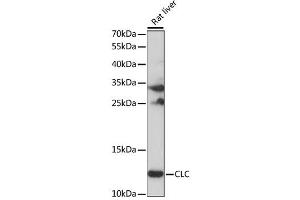 Western blot analysis of extracts of Rat liver, using CLC antibody (ABIN6292448) at 1:1000 dilution. (Galectin 10 抗体)