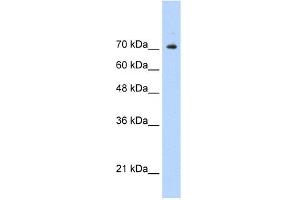 WB Suggested Anti-STAT1 Antibody Titration:  0. (STAT1 抗体  (C-Term))