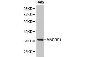 Western Blotting (WB) image for anti-Ankyrin Repeat and Sterile alpha Motif Domain Containing 1B (ANKS1B) antibody (ABIN1873638) (ANKS1B 抗体)