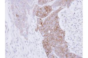 IHC-P Image Immunohistochemical analysis of paraffin-embedded DLD1 xenograft, using RAB3C, antibody at 1:500 dilution. (Rab3c 抗体)