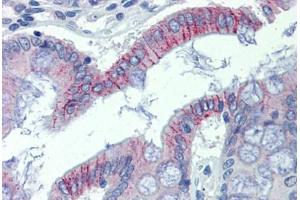 Colon, Human: Formalin-Fixed, Paraffin-Embedded (FFPE) (Desmoglein 2 抗体  (AA 72-121))