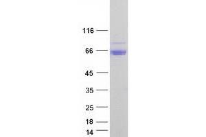 Western Blotting (WB) image for Arylsulfatase A (ARSA) (Transcript Variant 2) protein (Myc-DYKDDDDK Tag) (ABIN2714955)