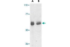 Western blot analysis of TRAF3IP2 expression in human lung (lane A) and placenta (lane B) tissue lysates with TRAF3IP2 polyclonal antibody  at 1 ug /mL . (TRAF3IP2 抗体  (AA 2-15))