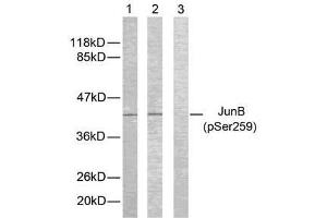 Western blot analysis of extracts from HeLa cells using JunB (phospho-Ser259) antibody (E011027). (JunB 抗体  (pSer259))