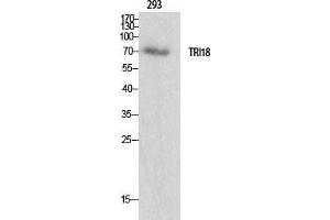 Western Blot (WB) analysis of specific cells using Midline-1 Polyclonal Antibody. (MID1 抗体  (N-Term))