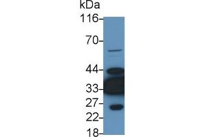 Detection of LDHB in Rat Heart lysate using Polyclonal Antibody to Lactate Dehydrogenase B (LDHB) (LDHB 抗体  (AA 1-334))
