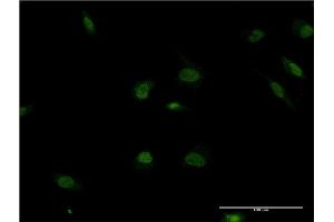 Immunofluorescence of monoclonal antibody to POLR2F on HeLa cell. (POLR2F 抗体  (AA 1-127))