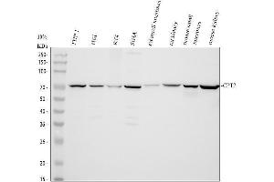 Western blot analysis of CPT2/CPT1 using anti-CPT2/CPT1 antibody (ABIN7601357).