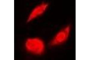 Immunofluorescent analysis of OSGEP staining in A549 cells. (OSGEP 抗体)