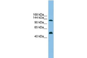 WB Suggested Anti-GART Antibody Titration: 0. (GART 抗体  (Middle Region))