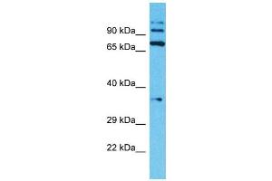Host: Rabbit Target Name: TMPRSS7 Sample Type: Jurkat Whole Cell lysates Antibody Dilution: 1.