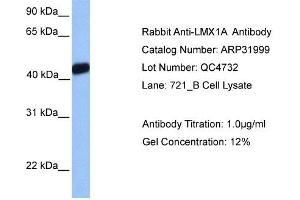 Western Blotting (WB) image for anti-LIM Homeobox Transcription Factor 1, alpha (LMX1A) (Middle Region) antibody (ABIN182469) (LMX1A 抗体  (Middle Region))