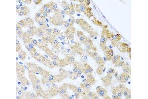 Immunohistochemistry of paraffin-embedded Human liver damage using CETN3 Polyclonal Antibody at dilution of 1:100 (40x lens). (CETN3 抗体)