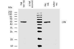 Western blotting analysis of human LYN using mouse monoclonal antibody LYN-01 on lysates of Raji cell line and Jurkat cell line (LYN non-expressing cell line, negative control) under non-reducing and reducing conditions.