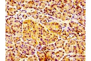 Immunohistochemistry of paraffin-embedded human pancreatic tissue using ABIN7156829 at dilution of 1:100 (IL18R1 抗体  (AA 22-128))