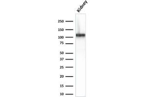 Western Blot Analysis of Human Kidney lysate using CDH16-Monospecific Mouse Monoclonal Antibody (CDH16/2125) (Cadherin-16 抗体  (AA 371-507))