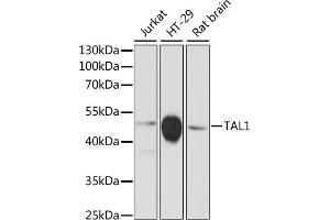 Western blot analysis of extracts of various cell lines, using T antibody (ABIN6132557, ABIN6148834, ABIN6148835 and ABIN6216741) at 1:3000 dilution. (TAL1 抗体  (AA 242-331))