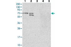 Western blot analysis of Lane 1: RT-4, Lane 2: U-251 MG, Lane 3: Human Plasma, Lane 4: Liver, Lane 5: Tonsil with BRAP polyclonal antibody  at 1:100-1:250 dilution. (BRAP 抗体)