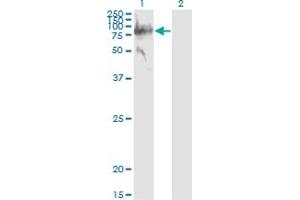 Western Blot analysis of SERPING1 expression in transfected 293T cell line by SERPING1 monoclonal antibody (M01), clone 3F4-1D9.
