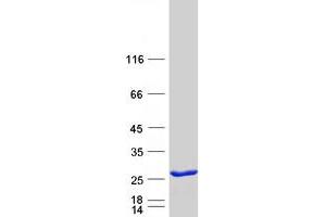 Western Blotting (WB) image for V-Ral Simian Leukemia Viral Oncogene Homolog B (Ras Related, GTP Binding Protein) (Ralb) protein (Myc-DYKDDDDK Tag) (ABIN2730432)