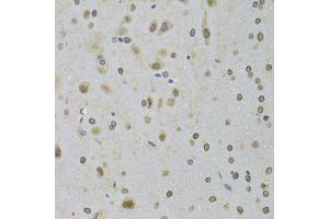 Immunohistochemistry of paraffin-embedded rat brain using DDX1 Antibody (ABIN5973950) at dilution of 1/100 (40x lens). (DDX1 抗体)