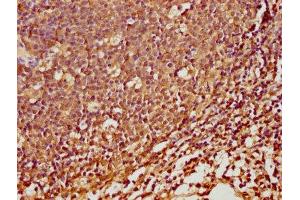 Immunohistochemistry (IHC) image for anti-serine Peptidase Inhibitor, Kazal Type 5 (SPINK5) (AA 722-847) antibody (ABIN7168929)
