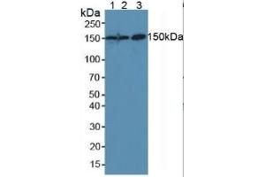 Detection antibody from the kit in WB with Positive Control:  Sample Lane1: Mouse Placenta Tissue; Lane2: Mouse Liver Tissue; Lane3: Human Hela Cells. (CEA ELISA 试剂盒)