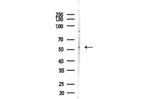 Western blot analysis of lysates from COLO205 cells(heat-shock,45 min treatment), using GN Antibody at 1/1000 dilution.