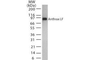 Image no. 1 for anti-Anthrax Toxin Lethal Factor (Lef) (AA 779-792) antibody (ABIN200035) (Anthrax Toxin Lethal Factor 抗体  (AA 779-792))