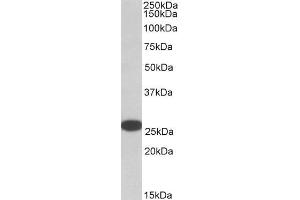 ABIN185257 (0. (RANBP1 抗体  (C-Term))