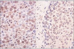 anti-Structural Maintenance of Chromosomes Flexible Hinge Domain Containing 1 (SMCHD1) (AA 250-300) antibody