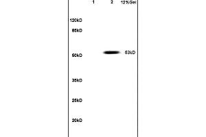 Lane 1: mouse embryo lysates Lane 2: human colon carcinoma lysates probed with Anti PAX3 Polyclonal Antibody, Unconjugated (ABIN737616) at 1:200 in 4C. (Paired Box 3 抗体  (AA 151-250))