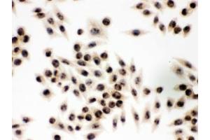 IHC testing of FFPE human SMMC-7221 cells with EIF3A antibody. (EIF6 抗体  (AA 66-210))