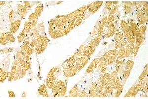 Immunohistochemistry of paraffin-embedded Rat heart using PLCB1 Polyclonal Antibody at dilution of 1:100 (40x lens). (Phospholipase C beta 1 抗体)