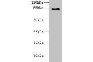 Western blot All lanes: LCA5 antibody at 18 μg/mL + Mouse kidney tissue Secondary Goat polyclonal to rabbit IgG at 1/10000 dilution Predicted band size: 81 kDa Observed band size: 81 kDa (LCA5 抗体  (AA 101-400))