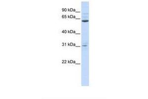 Image no. 1 for anti-Intestine-Specific Homeobox (ISX) (AA 36-85) antibody (ABIN6738368) (ISX 抗体  (AA 36-85))