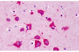 Human Brain, Cortex: Formalin-Fixed, Paraffin-Embedded (FFPE) (FKBP3 抗体  (AA 2-195))