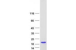 Western Blotting (WB) image for Retinol Binding Protein 2, Cellular (RBP2) protein (Myc-DYKDDDDK Tag) (ABIN2730760)