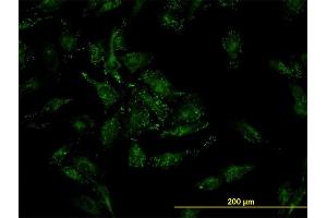 Immunofluorescence of monoclonal antibody to CFL2 on HeLa cell. (Cofilin 2 抗体  (AA 57-166))
