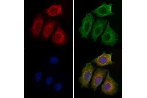 ABIN6259147 and ABIN6274943 staining Hela cells by IF/ICC. (PDE4C 抗体  (Internal Region))