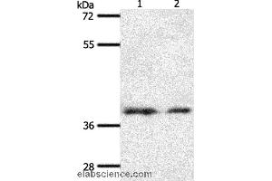 Western blot analysis of 293T and hela cell, using SSTR1 Polyclonal Antibody at dilution of 1:500 (SSTR1 抗体)