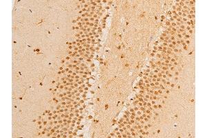 ABIN6267237 at 1/100 staining mouse brain tissue sections by IHC-P. (FOXO3 抗体  (pSer253))