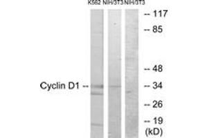 Western blot analysis of extracts from K562/NIH-3T3 cells, using Cyclin D1 (Ab-90) Antibody. (Cyclin D1 抗体  (AA 56-105))