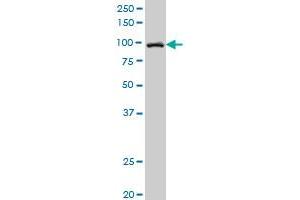SNX14 polyclonal antibody (A01), Lot # 051003JC01 Western Blot analysis of SNX14 expression in Y-79 . (SNX14 抗体  (AA 784-893))