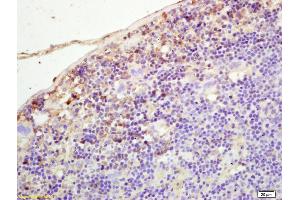 Immunohistochemistry (IHC) image for anti-Pleckstrin Homology Domain Containing, Family M (With RUN Domain) Member 2 (PLEKHM2) (AA 688-750) antibody (ABIN872446)